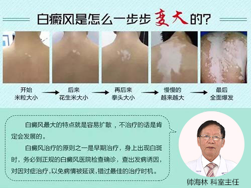 最新白癜风的治疗方法,最新白癜风治疗方法，打破沉默，重塑自信，最新白癜风治疗方法揭秘，打破沉默，重塑自信之路