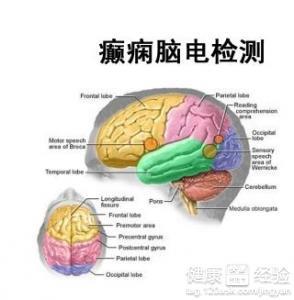 痫病的最新治疗方法,痫病最新治疗方法，曙光初现的希望之光，痫病最新治疗方法揭秘，曙光初现的希望之光