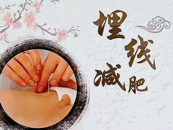 埋线减肥法的价格多少,揭秘埋线减肥法，价格背后的秘密与真相探寻，揭秘埋线减肥法，价格背后的真相与秘密探寻